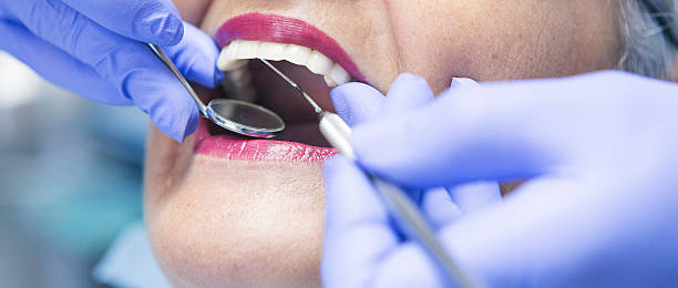 Best Teeth Whitening  in Franklin, CA
